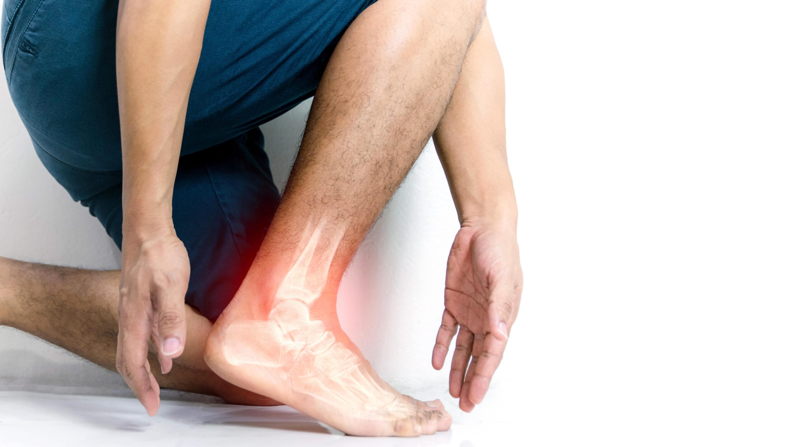 Plantar fasciitis - Institute of Regenerative Orthopedics & Sports Medicine