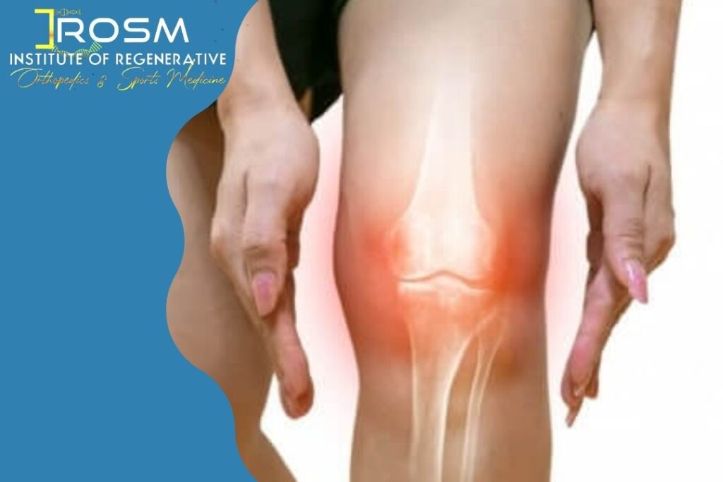 knee replacement surgery fort lauderdale