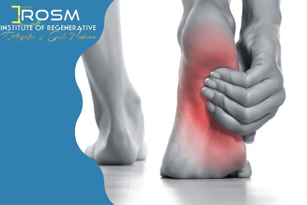 Patient holding a painful foot and ankle, evaluated for ankle arthritis treatment at IROSM in Fort Lauderdale