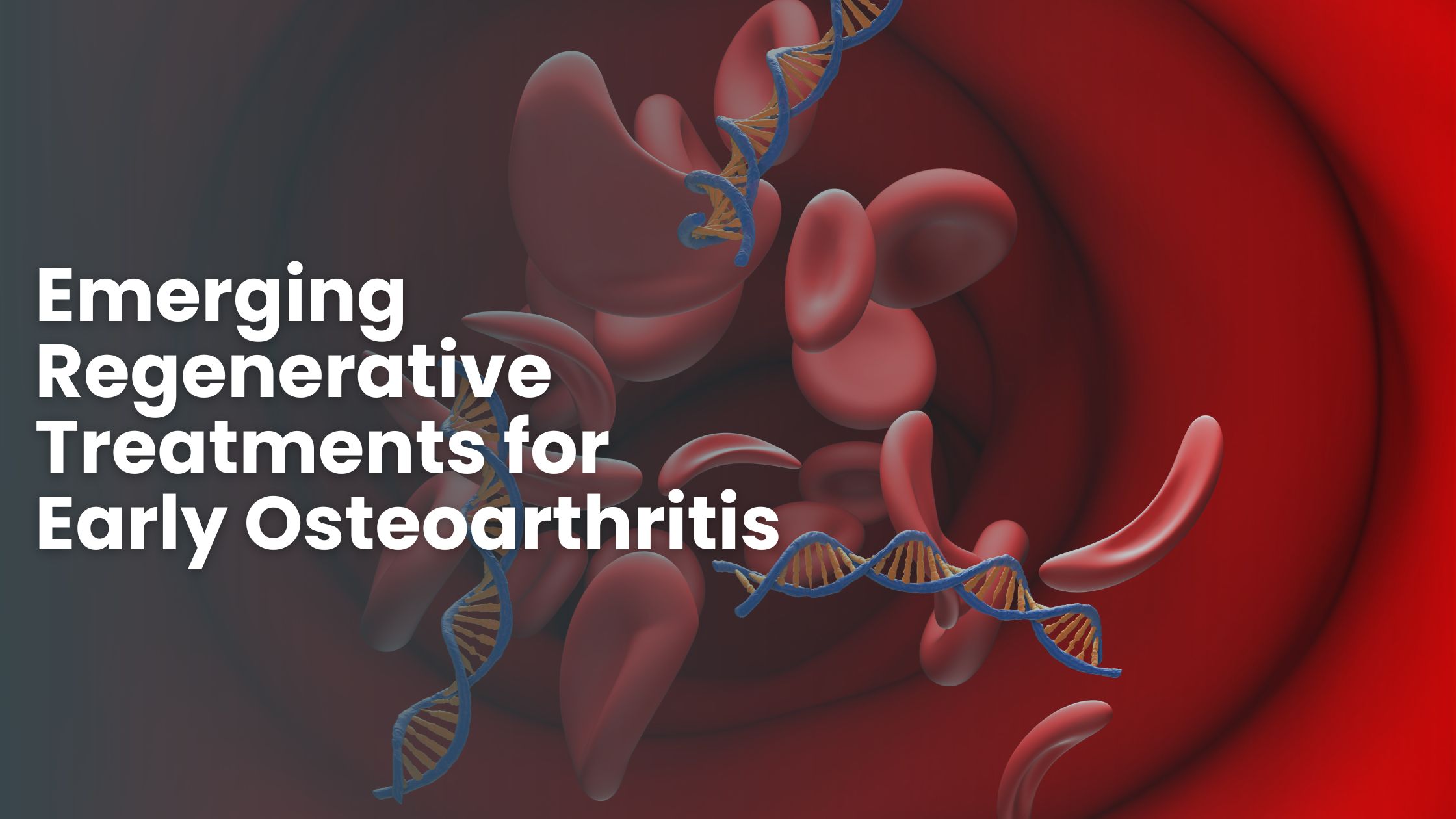 Emerging Regenerative Treatments for Early Osteoarthritis