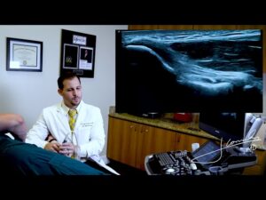 Stem Cell Therapy in Fort Lauderdale Are You a Candidate