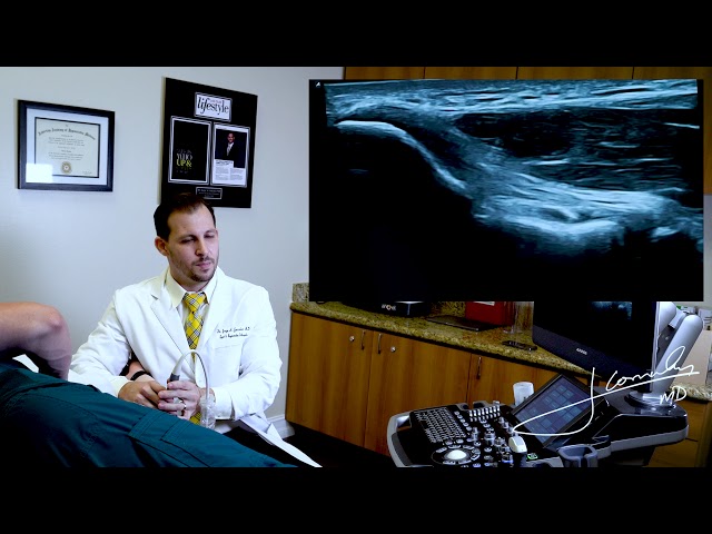Stem Cell Therapy in Fort Lauderdale Are You a Candidate